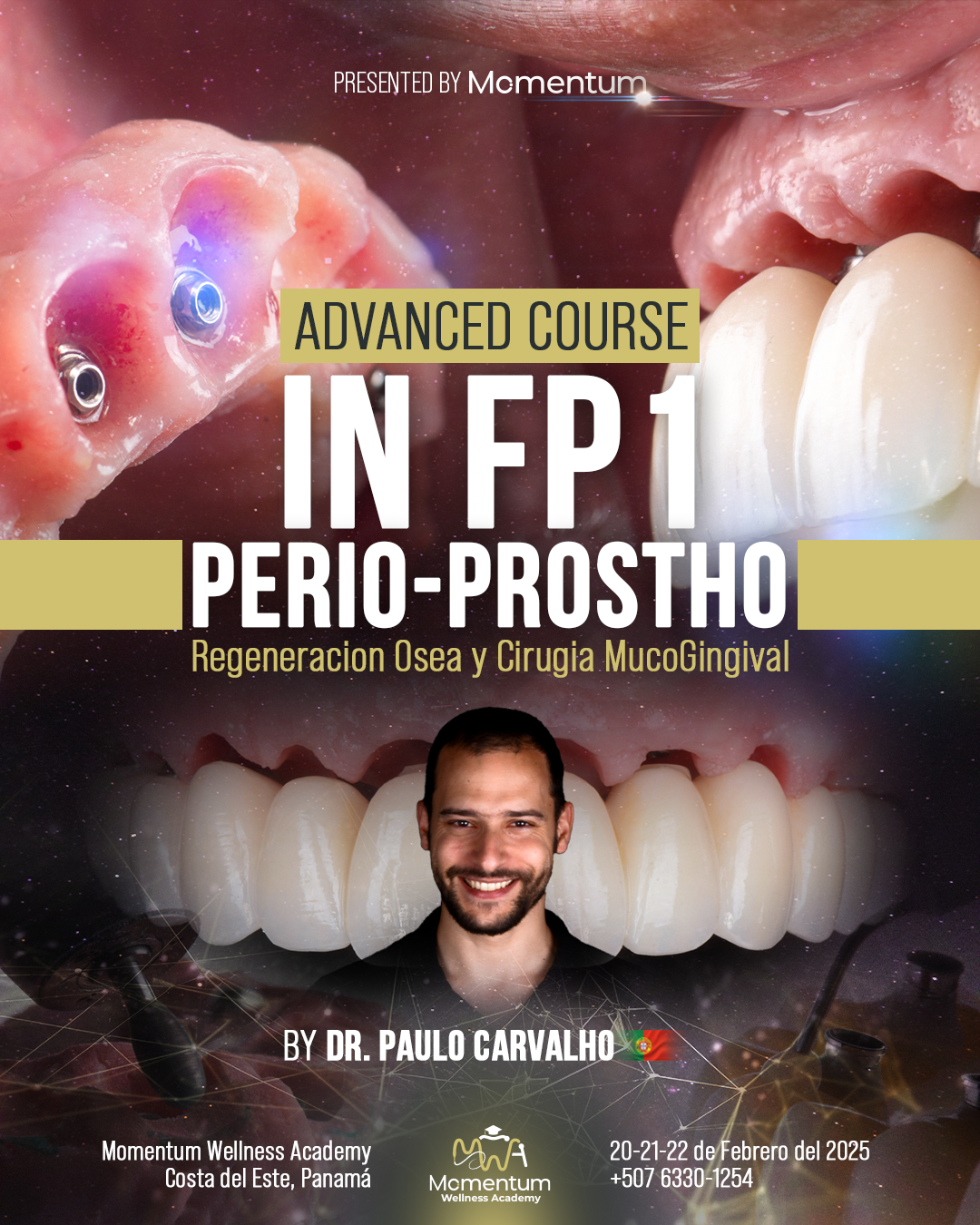 Advance Course in FP1 Perio Prostho w/ Dr. Paulo Carvalho